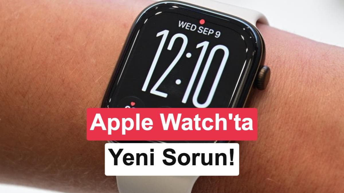 Apple Watch Series 12 ve Ultra 4 kullanıcıları cilt tahrişinden şikâyetçi